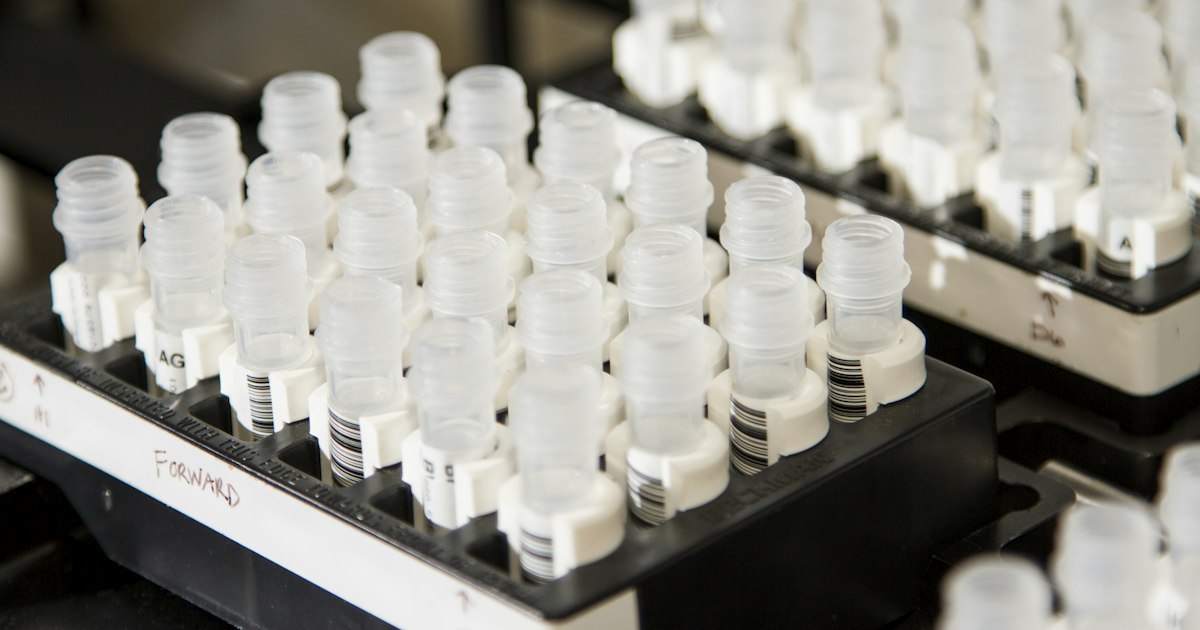 Glutamine vs BCAA: What to Choose and for Whom